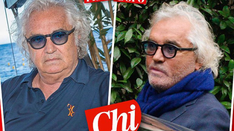 Flavio Briatore (pirms un pēc operācijas)
Foto: Chi