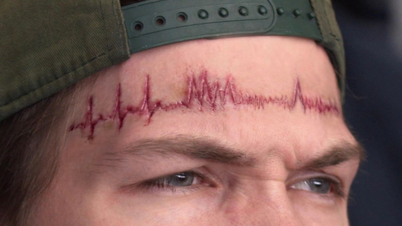 Helmuts Rodke: treniņu aritmija